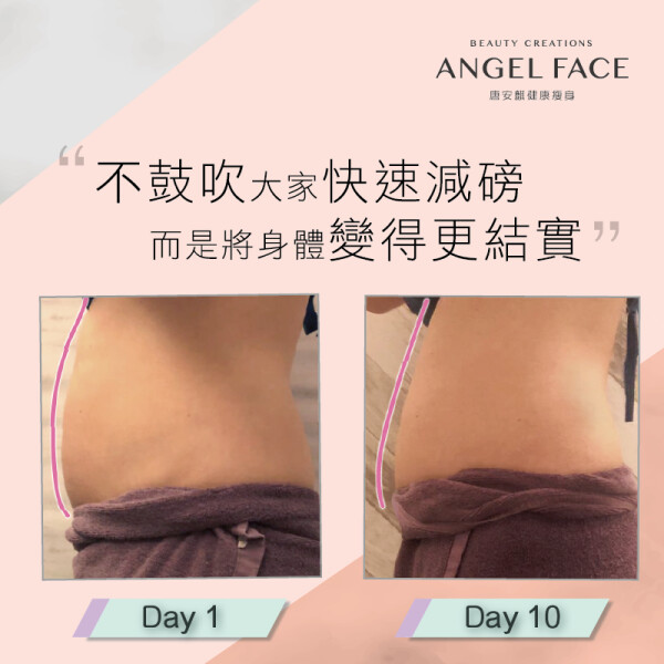 唐安麒豐胸瘦身專門店  ANGEL FACE-1-化妝美容